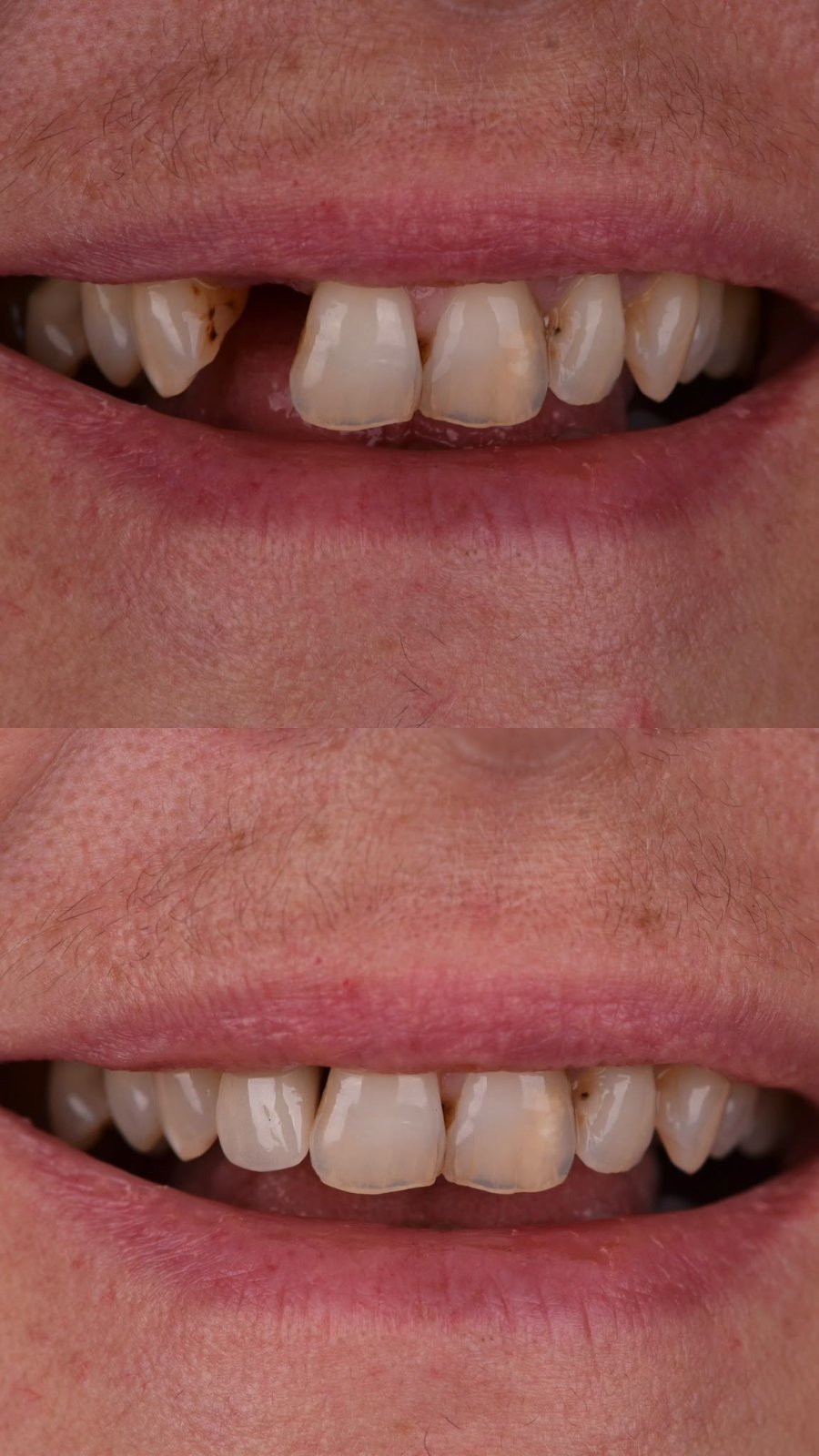 Before & After result