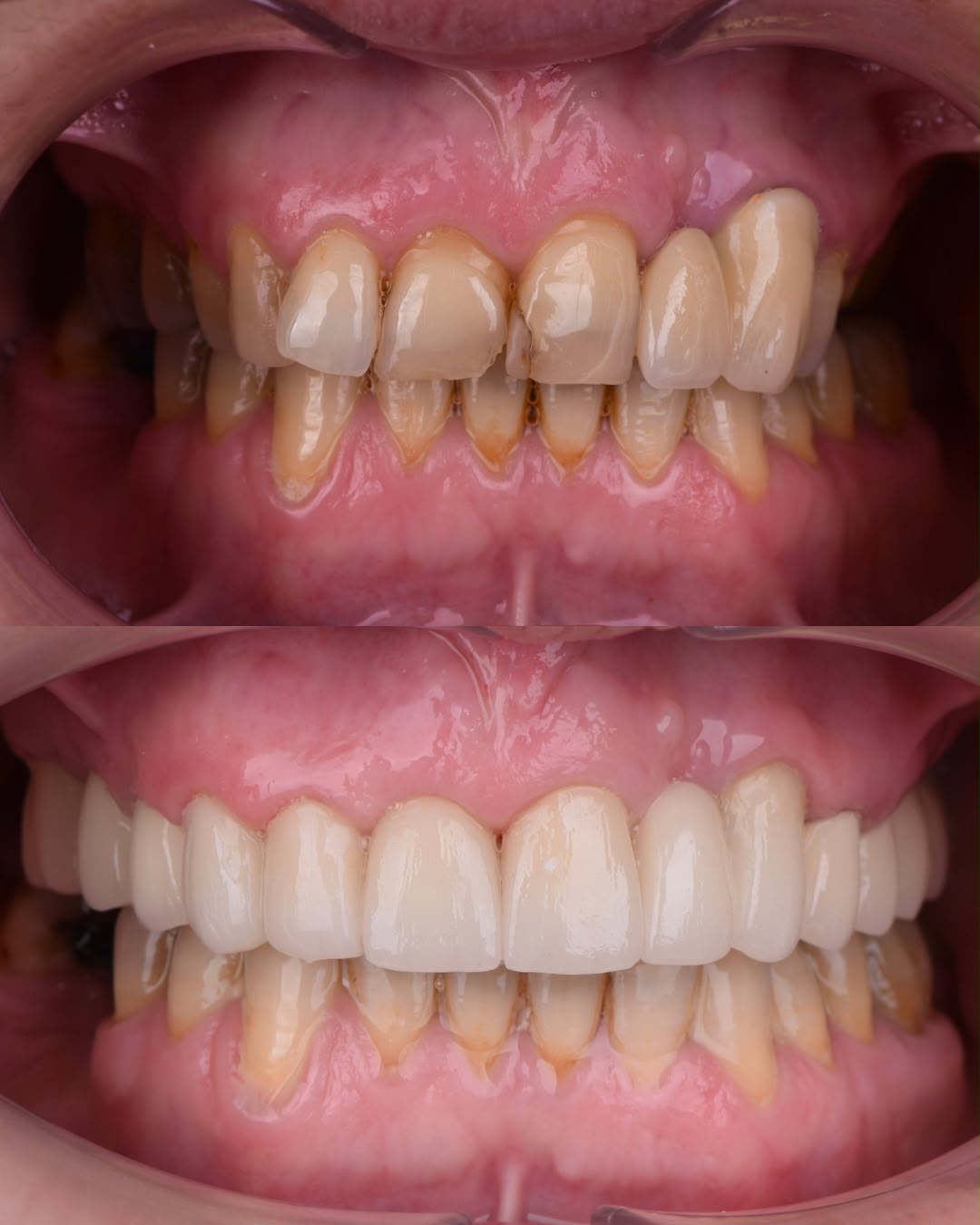 Before & After result