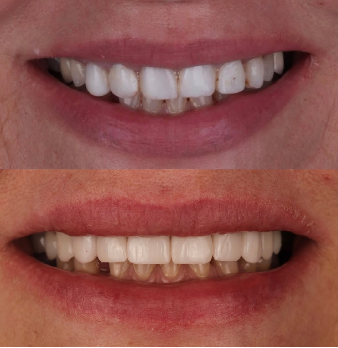 Before & After result
