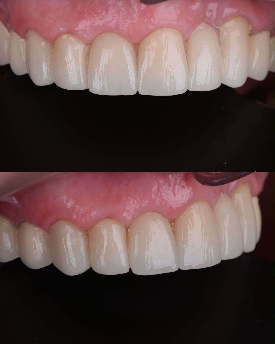 Before & After result