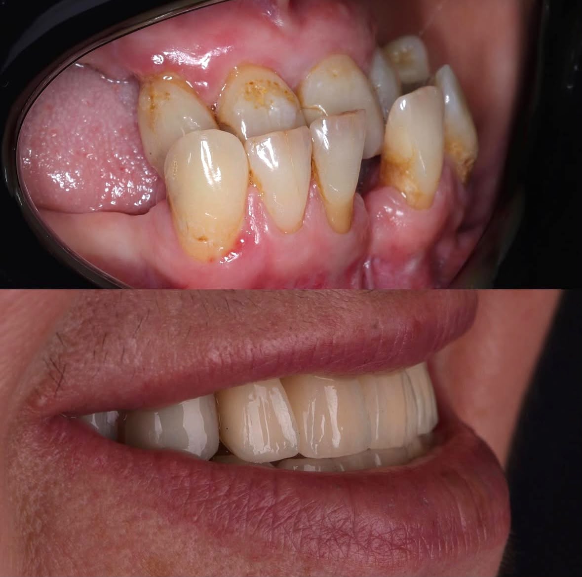 Before & After result