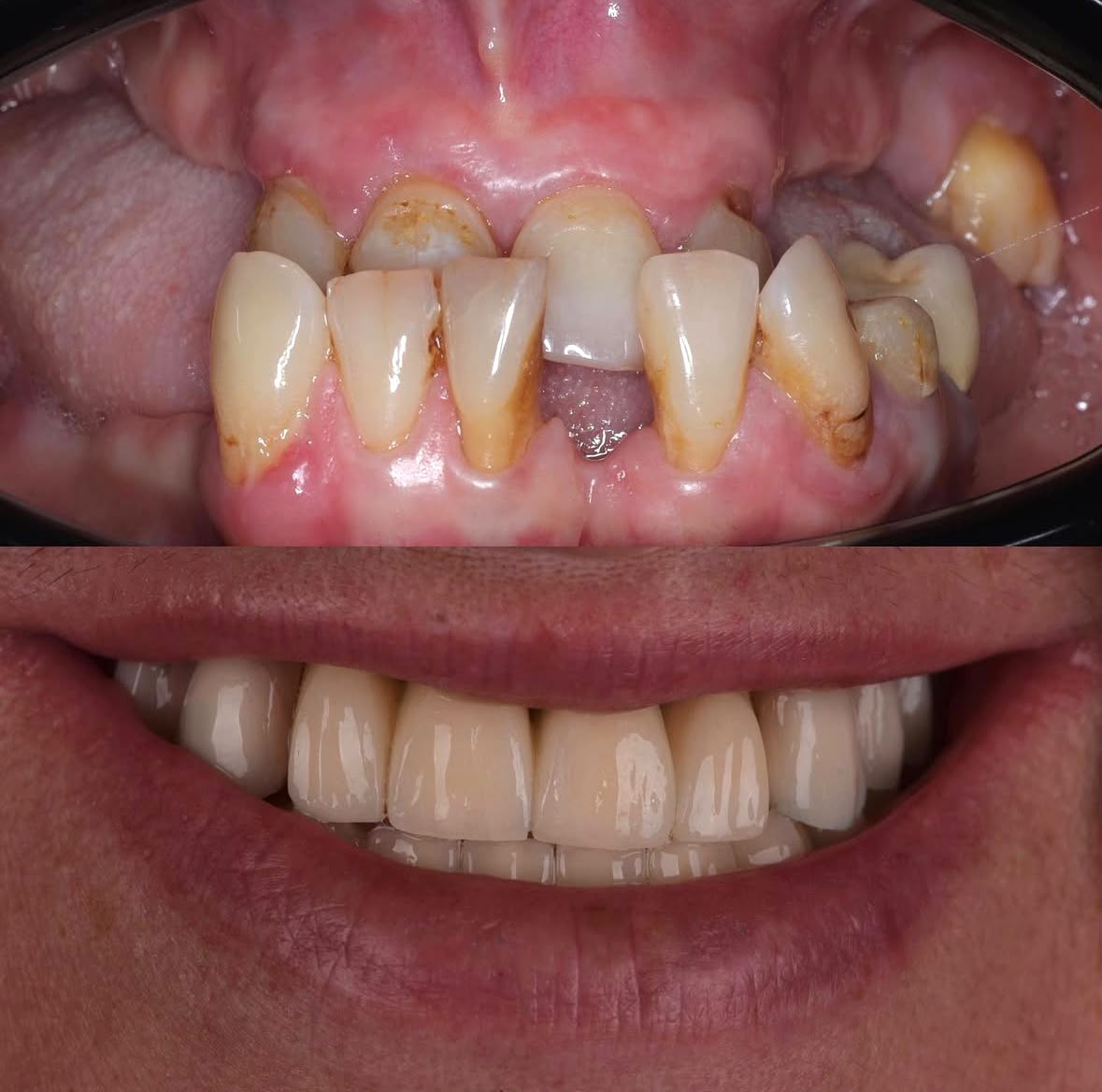 Before & After result
